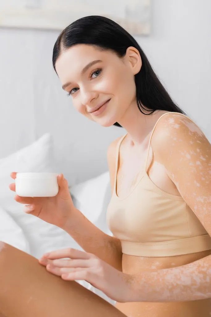 clinica para vitiligo en monterrey